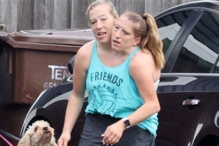 Abby and Brittany Hensel Sad News: Unpacking Recent Life Updates