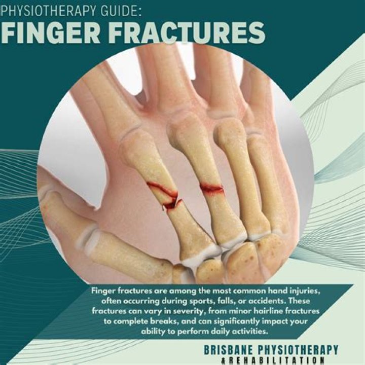 Brodie Moss Finger Injury: Unpacking the Wild Encounter and His Comeback
