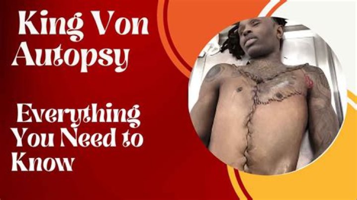 King Von Autopsy: Unveiling The Hidden Truths