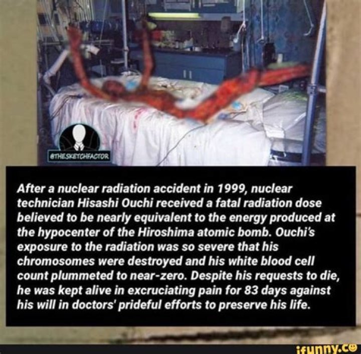 Understanding Hisashi Ouchi's Injuries: A Look at the Tokaimura Accident's Human Cost
