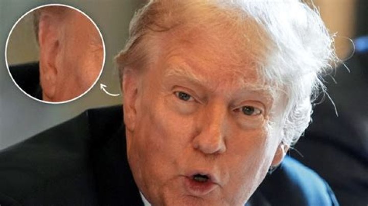 Unpacking the Public's Curiosity: Why Does Trump Have an Orange Face?