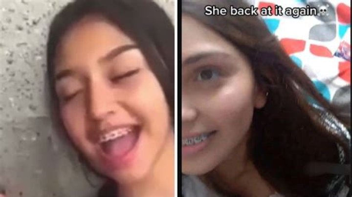 Unveiling "Skyleakss Braces Girl Leaked Viral": Discoveries And Insights