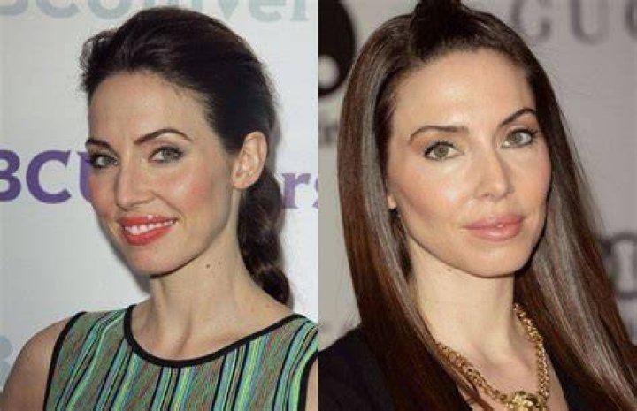 Whitney Cummings' Plastic Surgery Journey