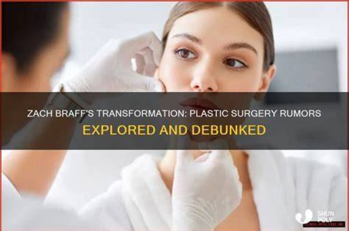 Zach Braff Plastic Surgery Explored & Explained